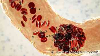 VTE Risk Substantially Lower in Breakthrough COVID Cases