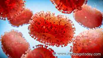 Is Monkeypox Neuroinvasive?
