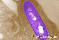 What is listeria? A microbiologist explains the bacterium behind recent deadly food poisoning outbreaks