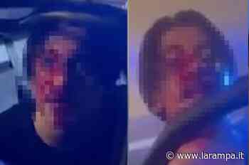 (VIDEO) Aversa. Sfonda volante della Polizia a testate - La Rampa