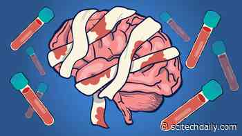 Early Blood Tests for Traumatic Brain Injury Can Accurately Predict Which Patients Are Likely To Die