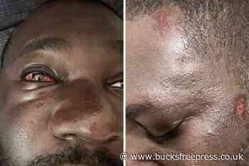 Wycombe attack leaves Beaconsfield man with fractured nose - Bucks Free Press