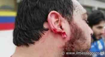 Rugby, orecchio staccato con un morso: condannato giocatore dell'Oderzo. La vittima: «Mai ricevuto scuse». L'o - ilmessaggero.it