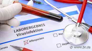 Affenpocken Bayern: Erster Fall im Landkreis Dachau - br.de