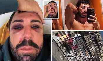 Sydney man shares horrific injuries from gay hate crime in Oxford St, Darlinghurst - Daily Mail