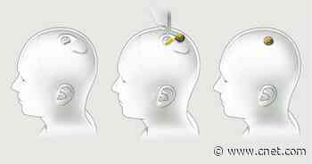 Elon Musk Says a Neuralink Update Is Coming on Halloween     - CNET