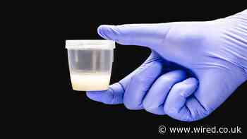 Egg and Sperm Donors Could Be Required to Share Medical Records