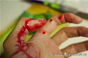 Andernach: Blutspur führt Polizei zu Schläger - Blick aktuell