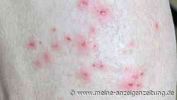 Neues Virus in Indien: Kommt nach Corona die Tomatengrippe?