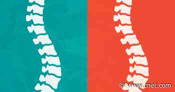 No More Lower Back Pain: 6 Common Causes and How to Treat Them     - CNET