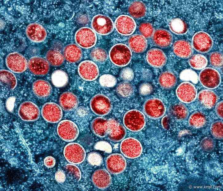 Monkeypox and schools: CDC releases new guidance