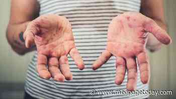 What's the Tomato Flu?
