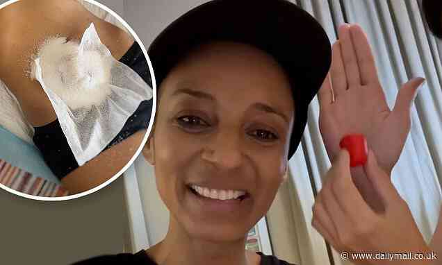 Adele Roberts reveals she suffered a prolapsed stoma that left her 'colon hanging out' - Daily Mail