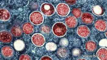 Test-Fehler in Pforzheim: Vierjährige hat doch keine Affenpocken - BILD