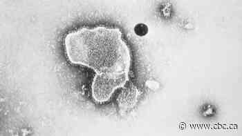 Moderna says RSV vaccine 84% effective at preventing symptoms in older adults