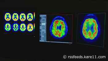MN experts, Alzheimer’s family advocates respond to latest FDA decision