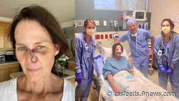 Kathy Sabine shares her skin cancer journey on social media, inspires others