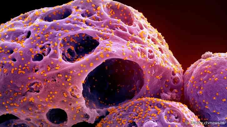 Hybrid immunity is 'best protection' against COVID-19, study finds