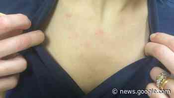 Acerra, due infermiere picchiate al pronto soccorso: "Il ragazzo non ... - QUOTIDIANO NAZIONALE