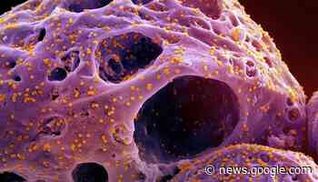 COVID-19 subvarient 'Kraken' on the rise in Ontario - Hamilton - CHCH News