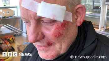 New Forest potholes plea after cyclists injured - BBC