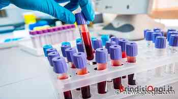 Analisi di laboratorio: modalità di accesso e prenotazione - Brindisi ... - BrindisiOggi