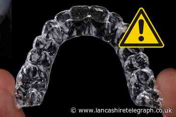 Dentists warn over 'disastrous' clear braces on Instagram