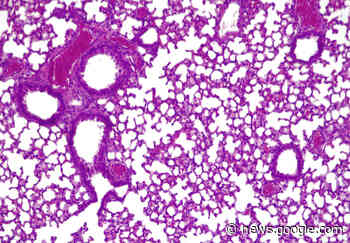 „Lebende Medizin“ gegen resistente Keime - wissenschaft.de