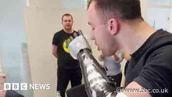 Ukrainian soldiers receive bionic arms