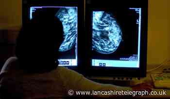 NHS figures show drop in Blackburn cancer diagnoses