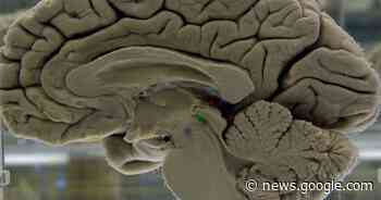 Veteran brain bank to understand trauma - Western Advocate