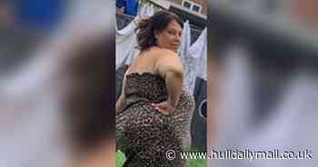 Mum-of-five who 'yo-yo dieted whole life' sheds eight stone after Turkey trip for gastric operation