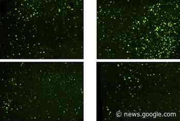 Missing mechanism helps solve fragile X protein mystery - Spectrum - Autism Research News