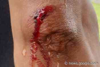 Artistas são agredidos por policiais militares em evento em Anchieta - Século Diário