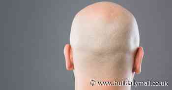 Peaky Blinders creator needs 'skinheads' for new drama This Town