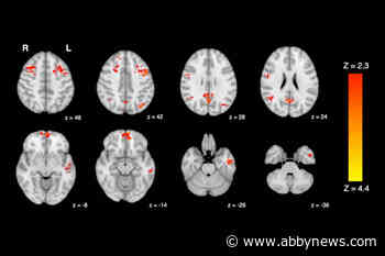 Traffic pollution can impair brain function, say B.C. researchers
