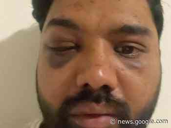 Rovereto, rider picchiato dopo una consegna: Ho perso i sensi e mi ... - Fanpage.it