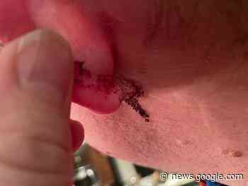 Owl attacks skiers at Stake Lake - Kamloops This Week