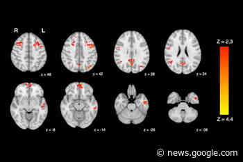 Traffic pollution can impair brain function, say B.C. researchers - Kitimat Northern Sentinel