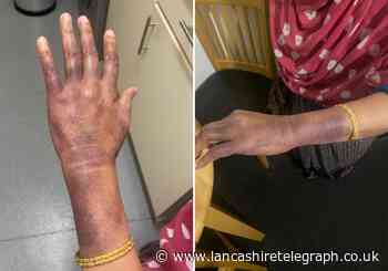 ‘Horrific’ dog attack leaves woman, 85, bruised and traumatised