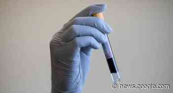 New test could detect Alzheimer’s disease years before diagnosis - Hackney Gazette