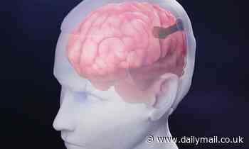 Brain implant thinner than a single human hair could allow you to use social media with your MIND