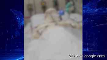 Mulher que teve 70% do corpo queimado em Cascavel é transferida ... - Catve