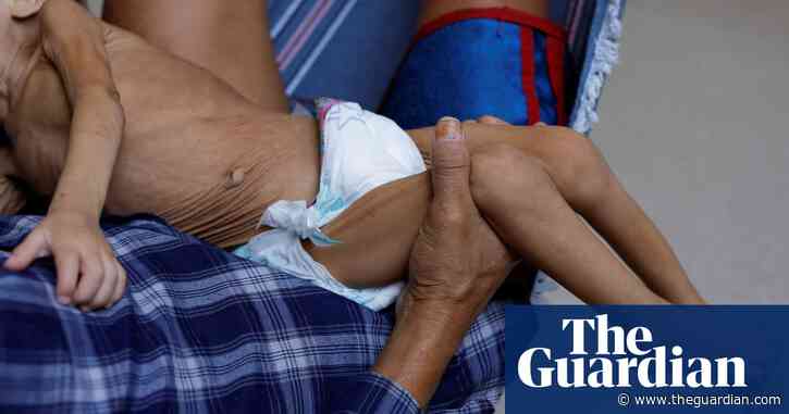 Brazil: dozens of Indigenous children hospitalised amid health crisis