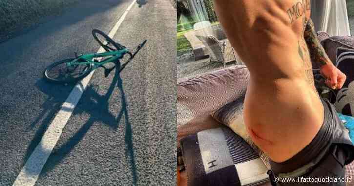 Conor McGregor investito da un’auto: “Grazie al wrestling, mi ha salvato a vita”