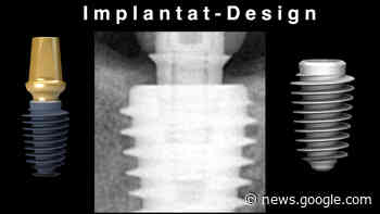 Die dentale Implantologie ist digital – ZWP online – das ... - ZWP Online - Das Nachrichtenportal für die Dentalbranche