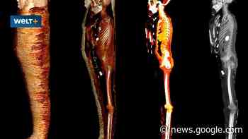 Mumie: Der ägyptische Junge bekam 49 Amulette für die Reise ins ... - WELT