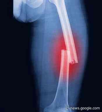 ATUALIZAÇÃO- Itaperuna: Paciente no PU com fratura de fêmur ... - Flávia Pires