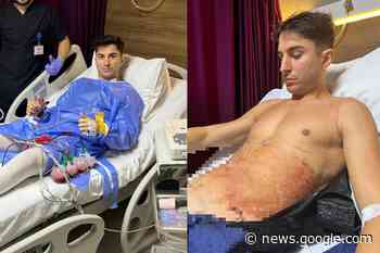 Anima si opera all'addome e viene criticato, lui replica! - Webboh