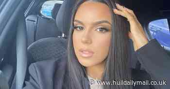 Make-up artist targeted by bullies for extreme underbite finally able to smile